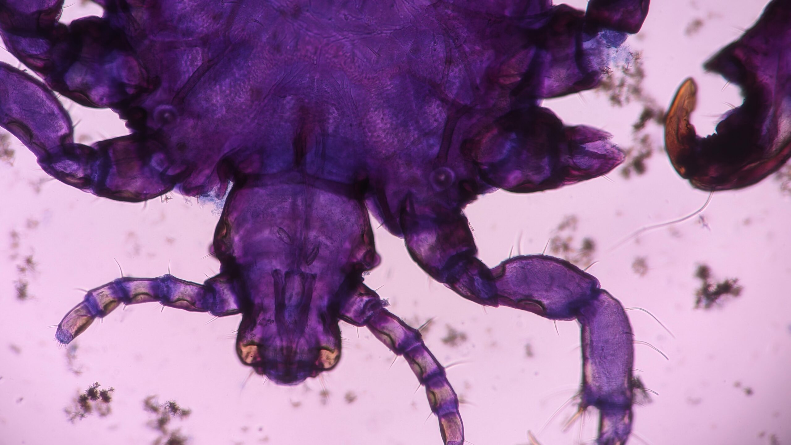 head louse